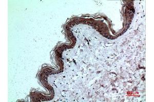 Immunohistochemistry (IHC) analysis of paraffin-embedded Human Skin, antibody was diluted at 1:100. (IL-8 anticorps  (C-Term))
