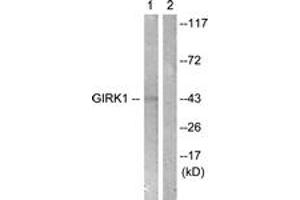 Western blot analysis of extracts from NIH-3T3 cells, using GIRK1/KIR3. (KCNJ3 anticorps  (AA 151-200))