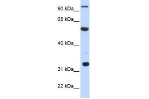 ApoBEC1 antibody used at 1 ug/ml to detect target protein. (APOBEC1 anticorps  (N-Term))