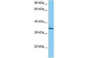 Host:  Mouse  Target Name:  ANXA5  Sample Tissue:  Mouse Brain  Antibody Dilution:  1ug/ml