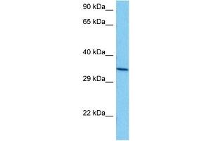 Host:  Mouse  Target Name:  ANXA5  Sample Tissue:  Mouse Brain  Antibody Dilution:  1ug/ml (Annexin V anticorps  (N-Term))