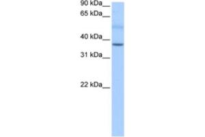 Western Blotting (WB) image for anti-SERTA Domain Containing 2 (SERTAD2) antibody (ABIN2463442) (SERTAD2 anticorps)