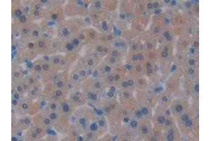 Detection of PRSS2 in Mouse Liver Tissue using Polyclonal Antibody to Protease, Serine 2 (PRSS2)