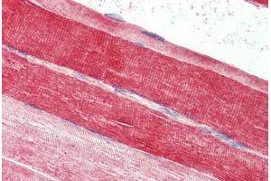 Skeletal muscle, Human: Formalin-Fixed, Paraffin-Embedded (FFPE)