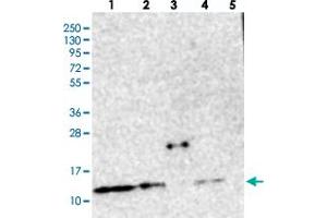 Western blot analysis of Lane 1: RT-4, Lane 2: U-251 MG, Lane 3: Human Plasma, Lane 4: Liver, Lane 5: Tonsil with CHCHD5 polyclonal antibody  at 1:250-1:500 dilution. (CHCHD5 anticorps)