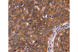 Immunohistochemistry (IHC) image for anti-Coiled-Coil Domain Containing 106 (CCDC106) antibody (ABIN2423069) (CCDC106 anticorps)