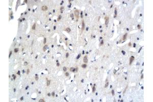 Formalin-fixed and paraffin embedded rat brain tissue labeled with Anti-PKC epsilon Polyclonal Antibody, Unconjugated (ABIN679538) followed by conjugation to the secondary antibody (PKC epsilon anticorps  (AA 631-737))