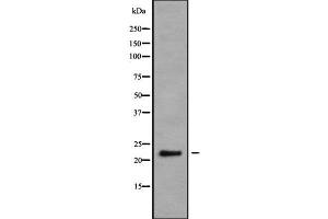 Western blot analysis NRSN2 using K562 whole cell lysates (NRSN2 anticorps  (C-Term))