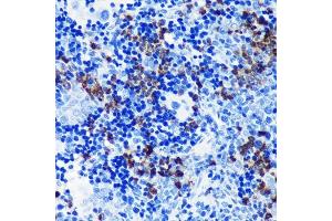 Immunohistochemistry of paraffin-embedded rat spleen using S100 Rabbit mAb (ABIN7270128) at dilution of 1:100 (40x lens).