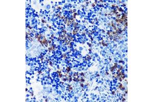 Immunohistochemistry of paraffin-embedded rat spleen using S100 Rabbit mAb (ABIN7270128) at dilution of 1:100 (40x lens). (S100A8 anticorps)