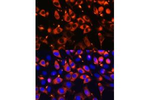 Immunofluorescence analysis of L929 cells using B9D1 Rabbit pAb (ABIN6133363, ABIN6137409, ABIN6137410 and ABIN6223982) at dilution of 1:100. (B9D1 anticorps  (AA 1-130))