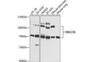 anti-RNA Binding Motif Protein 15B (RBM15B) (AA 540-720) antibody