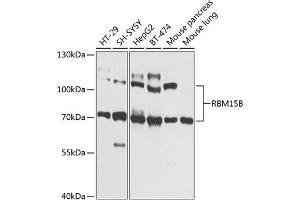 Western blot analysis of extracts of various cell lines, using RBM15B Antibody (ABIN6133322, ABIN6146763, ABIN6146764 and ABIN6225211) at 1:1000 dilution. (RBM15B anticorps  (AA 540-720))