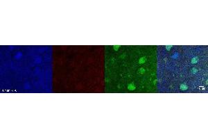 Immunohistochemistry (IHC) image for anti-Aldehyde Dehydrogenase 1 Family, Member A1 (ALDH1A1) antibody (ABIN7456135) (ALDH1A1 anticorps)
