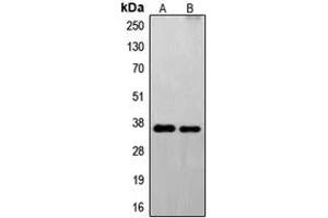 Western blot analysis of FAIM2 expression in U251 (A), EL4 (B) whole cell lysates. (FAIM2 anticorps  (N-Term))