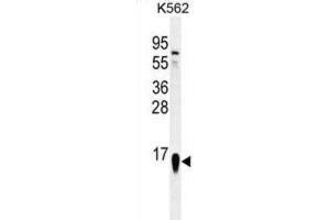 Western Blotting (WB) image for anti-Ribosomal Protein S19 (RPS19) antibody (ABIN2996506)
