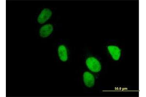 Immunofluorescence of purified MaxPab antibody to UBA2 on HeLa cell. (UBA2 anticorps  (AA 1-640))