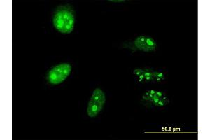 Immunofluorescence of monoclonal antibody to TP53RK on HeLa cell. (TP53RK anticorps  (AA 154-253))
