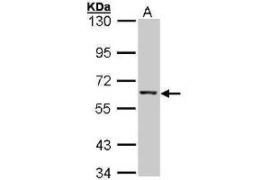 WB Image Sample (30 ug of whole cell lysate) A: Hep G2 , 7.