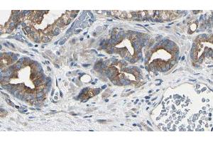 ABIN6279781 at 1/100 staining Human prostate tissue by IHC-P. (RPL22/L1 anticorps)