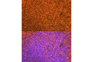 Immunofluorescence analysis of mouse spleen cells using EBI3 Rabbit mAb (ABIN7268011) at dilution of 1:100 (40x lens). (EBI3 anticorps)