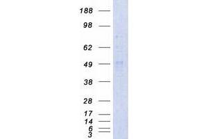 Validation with Western Blot