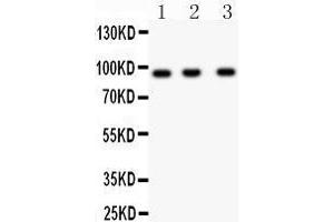 Western Blotting (WB) image for anti-Neural Precursor Cell Expressed, Developmentally Down-Regulated 9 (NEDD9) (AA 273-421) antibody (ABIN3043271) (NEDD9 anticorps  (AA 273-421))