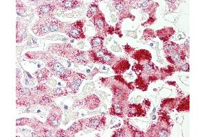 Anti-SCP2 antibody IHC of human liver. (SCP2 anticorps  (AA 163-175))
