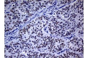 Image no. 3 for anti-Nibrin (NBN) (AA 183-460) antibody (ABIN1491067) (Nibrin anticorps  (AA 183-460))