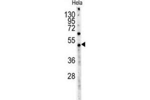 Western Blotting (WB) image for anti-Myc Tag antibody (ABIN3004426)