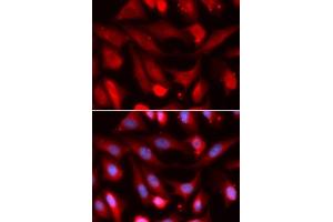 Immunofluorescence analysis of U2OS cells using SMAD4 antibody.