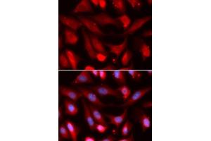 Immunofluorescence analysis of U2OS cells using SMAD4 antibody. (SMAD4 anticorps  (AA 160-450))