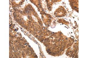 Immunohistochemistry (IHC) image for anti-Chemokine (C-C Motif) Ligand 17 (CCL17) antibody (ABIN1679017) (CCL17 anticorps)