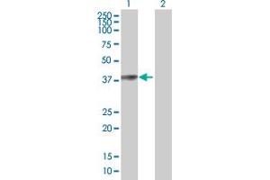 Western Blot analysis of PARK2 expression in transfected 293T cell line by PARK2 MaxPab polyclonal antibody.