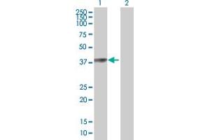 Western Blot analysis of PARK2 expression in transfected 293T cell line by PARK2 MaxPab polyclonal antibody. (Parkin anticorps  (AA 1-387))