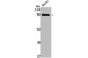 Western Blot analysis of HuvEc cells using Cadherin-16 Polyclonal Antibody (Cadherin-16 anticorps  (C-Term))