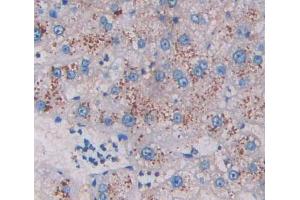 IHC-P analysis of liver tissue, with DAB staining. (HADH anticorps  (AA 1-236))