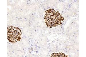 Immunohistochemistry analysis of paraffin-embedded rat kidney using NES Monoclonal Antibody at dilution of 1:400.
