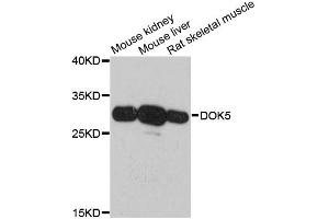Western blot analysis of extracts of various cell lines, using DOK5 antibody. (DOK5 anticorps)