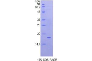 SDS-PAGE of Protein Standard from the Kit (Highly purified E. (QSOX1 Kit ELISA)