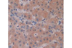 IHC-P analysis of liver tissue, with DAB staining. (Phospholipase C delta 3 anticorps  (AA 528-789))