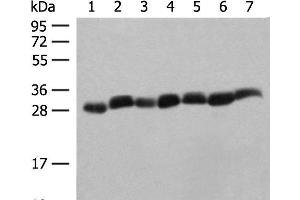 Western blot analysis of Hela cell Mouse spleen tissue Mouse liver tissue PC3 cell HL60 cell A549 cell NIH/3T3 cell lysates using PSMA3 Polyclonal Antibody at dilution of 1:350 (PSMA3 anticorps)