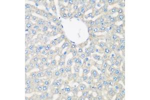 Immunohistochemistry of paraffin-embedded rat liver using C3 antibody (ABIN5975433) at dilution of 1/200 (40x lens). (C3 anticorps)