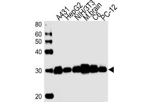 Lane 1: A431 Cell lysates, Lane 2: HepG2 Cell lysates, Lane 3: NIH/3T3 Cell lysates, Lane 4: mouse brain lysates, Lane 5: C6 Cell lysates, Lane 6: PC-12 Cell lysates, probed with YWHAZ (1314CT423. (14-3-3 zeta anticorps)