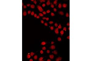 ABIN6267372 staining LOVO by IF/ICC.