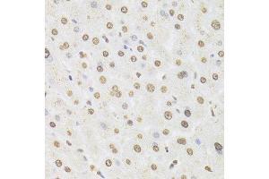 Immunohistochemistry of paraffin-embedded human liver using HNRNPD Antibody.
