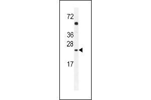 GOLGA2L1 Antibody (C-term) (ABIN654533 and ABIN2844251) western blot analysis in A549 cell line lysates (35 μg/lane). (GOLGA2P5 anticorps  (C-Term))