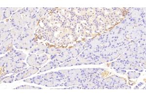 Detection of TF in Rat Pancreas Tissue using Polyclonal Antibody to Tissue Factor (TF)