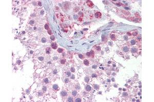 Anti-SYCP3 antibody IHC of human testis.