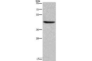 Western blot analysis of Human adrenal gland tissue, using HSD3B1 Polyclonal Antibody at dilution of 1:250 (HSD3B1 anticorps)